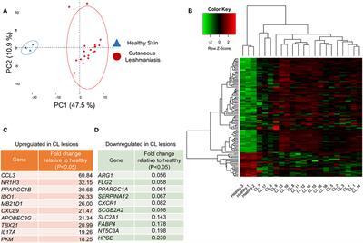 Transcriptional Analysis of Human Skin Lesions Identifies Tryptophan-2,3-Deoxygenase as a Restriction Factor for Cutaneous Leishmania